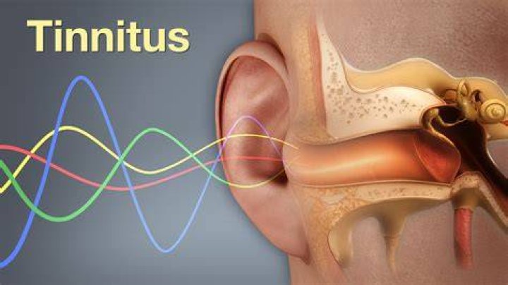 Anxiety and Tinnitus