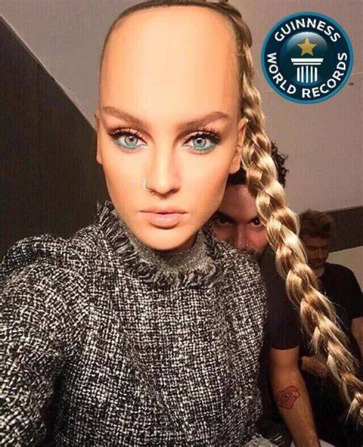 biggest forehead in the world biggest forehead in the world